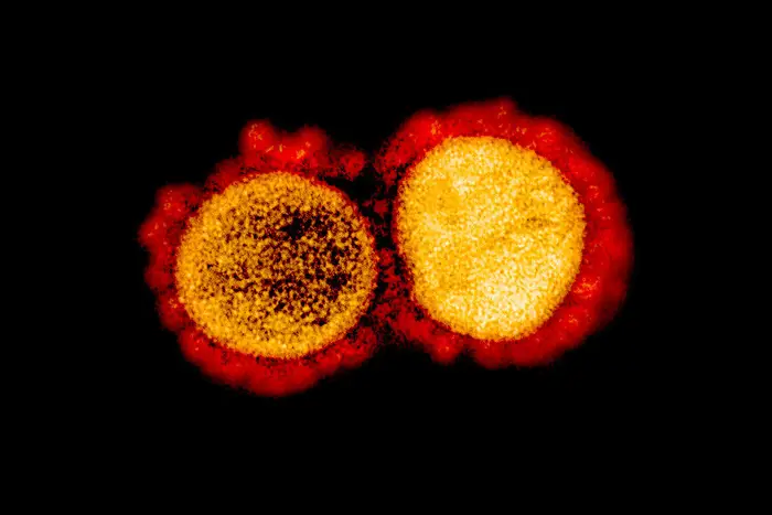 Transmission electron micrograph of SARS-CoV-2 virus particles, isolated from a patient. Image captured and color-enhanced at the NIAID Integrated Research Facility (IRF) in Fort Detrick, Maryland.